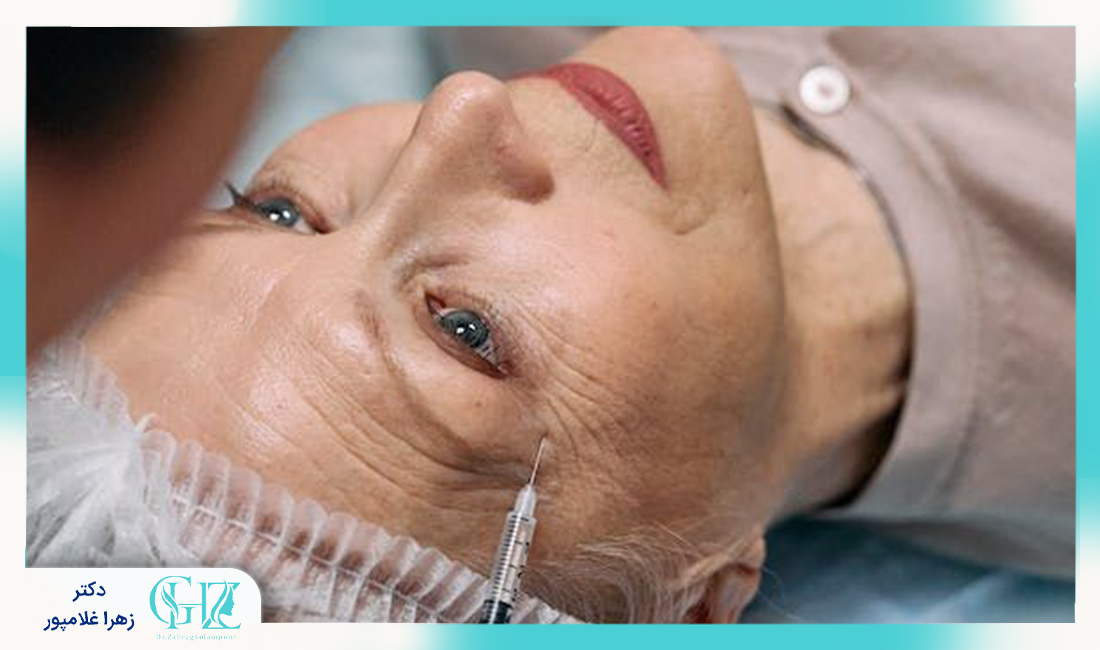 عوارض و خطرات احتمالی بوتاکس