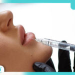 تزریق ژل در فسا | جوانسازی و زیبایی پوست